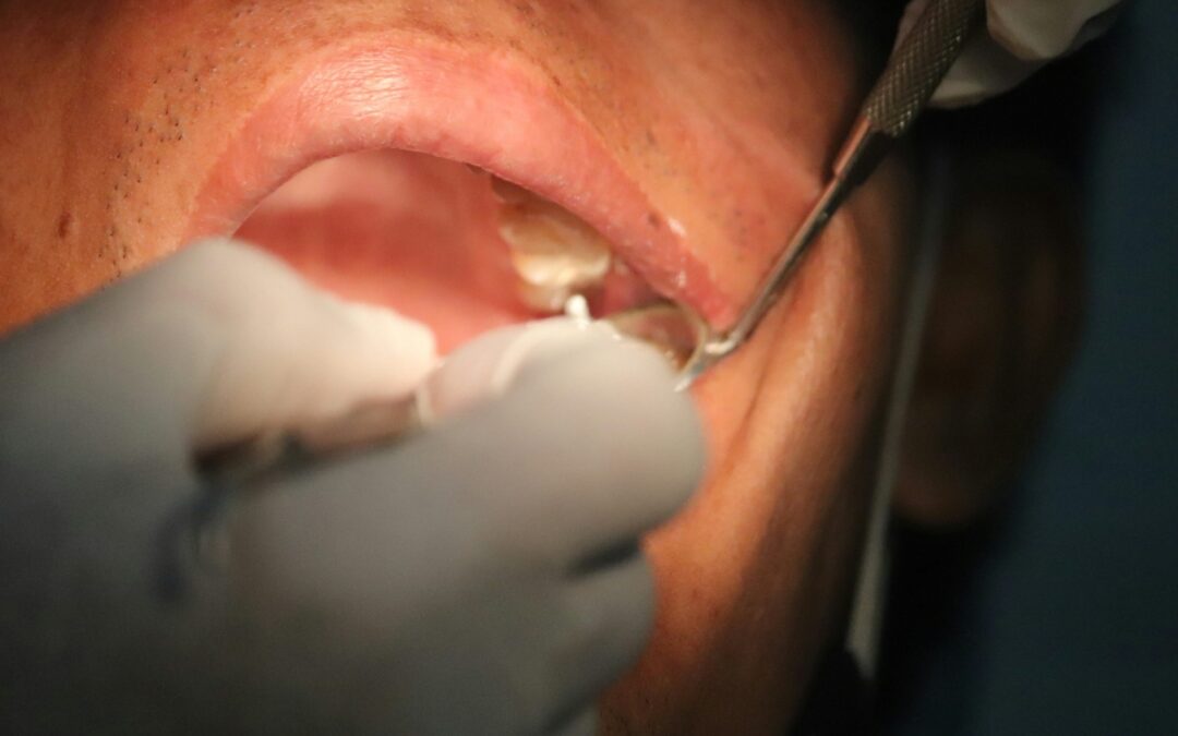 Sedation dentist in Gainesville